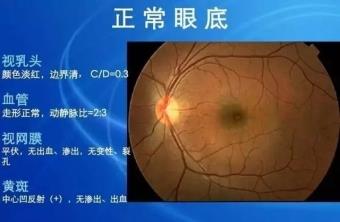 下載 (1)